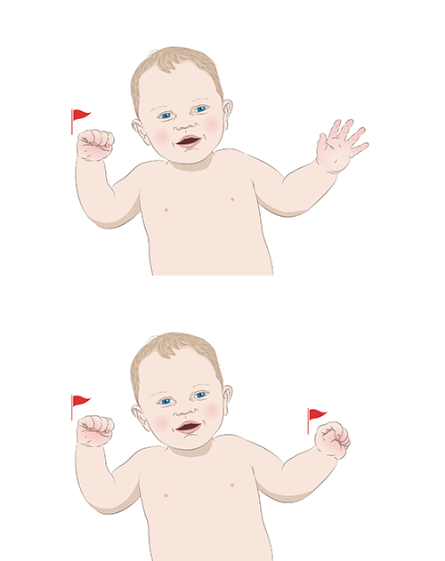 Child has one or both hands in fists